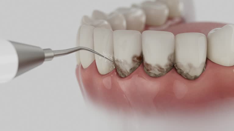 Reliable Dental Implants contractor in University, MS by Smile Center Dentistry